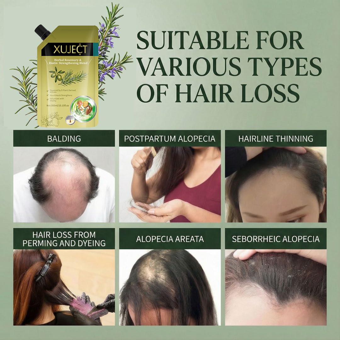 XUJECT Shampoo for Thinning Hair for Women and Men– Rosemary Hair Growth Shampoo with Biotin, Strengthening & Volumizing Formula for Fuller Looking Hair, 10.15 fl oz- 2 Packs