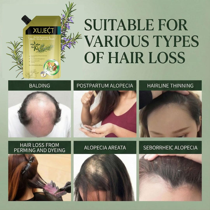 XUJECT Shampoo for Thinning Hair for Women and Men– Rosemary Hair Growth Shampoo with Biotin, Strengthening & Volumizing Formula for Fuller Looking Hair, 10.15 fl oz- 2 Packs