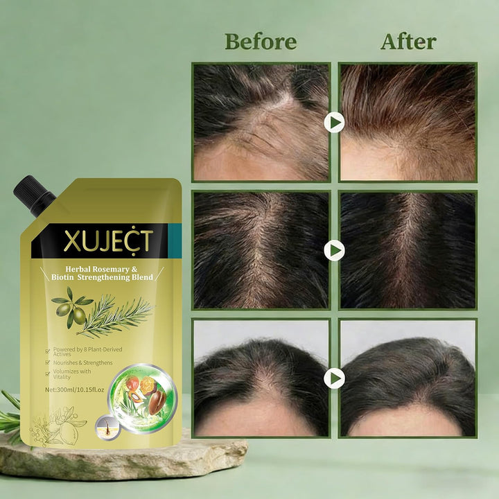 XUJECT Shampoo for Thinning Hair for Women and Men– Rosemary Hair Growth Shampoo with Biotin, Strengthening & Volumizing Formula for Fuller Looking Hair, 10.15 fl oz- 2 Packs