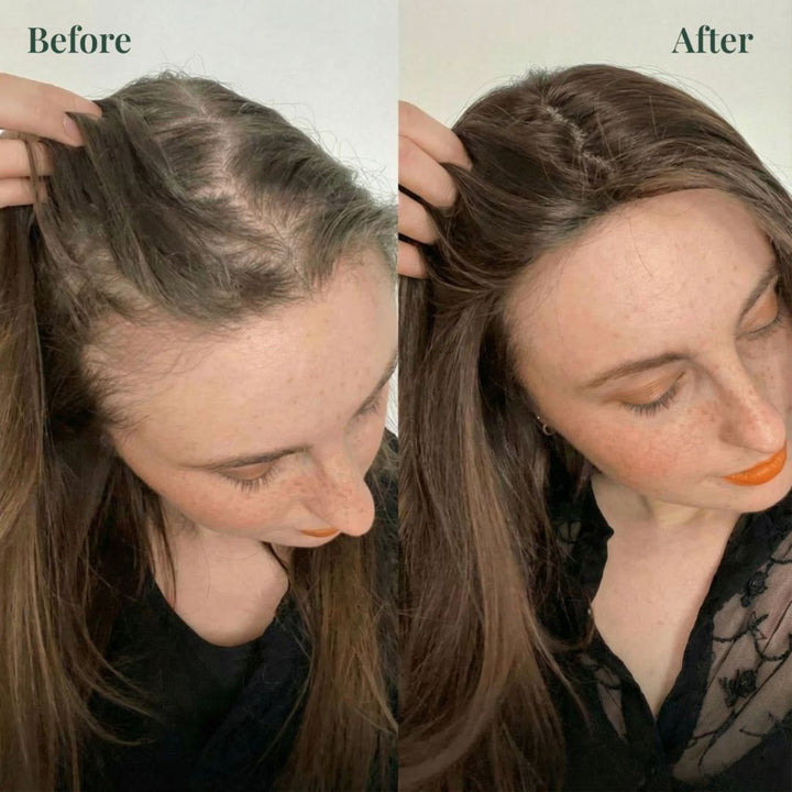 XUJECT Growth Support Shampoo-（Buy One, Get One Free）